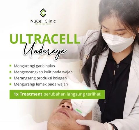 Mengatasi Kantung Mata dan Kulit Kendur, Tips dan Perawatan Terbaik di Nucell Clinic